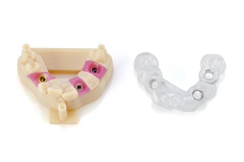 dental teaser